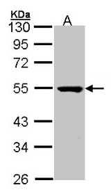Sample (30 ug of whole cell lysate). A: Molt-4 . 10 % SDS PAGE. PSKH1 antibody diluted at 1:1000