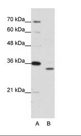 A: Marker, B: Jurkat Cell Lysate