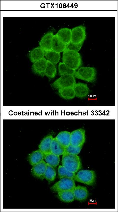 Immunofluorescence of paraformaldehyde-fixed A431 using RGS17 antibody at 1:200 dilution.