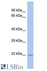RGS17 / RGSZ2 antibody Western Blot of COLO205. Antibody dilution: 1 ug/ml.