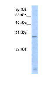RGS18 antibody LS-C40399 Western blot of Fetal Thymus lysate.