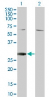 Western blot of RGS18 in 1) transfected 293T cells and 2) untransfected 293T cells using LS-C148190 at 1:500.