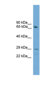 RGS18 antibody LS-C117101 Western blot of Mouse Lung lysate.