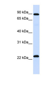 RGS19 antibody LS-C109855 Western blot of Fetal Lung lysate.