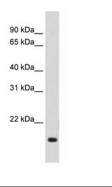 SP2/0 Cell Lysate