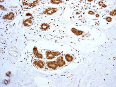 IHC of paraffin-embedded human breast tissue using anti-PSMA1 antibody.