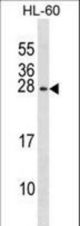 RGS2 Antibody western blot of HL-60 cell line lysates (35 ug/lane). The RGS2 antibody detected the RGS2 protein (arrow).