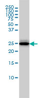 RGS2 monoclonal antibody (M01), clone 4C4 Western blot of RGS2 expression in MCF-7.