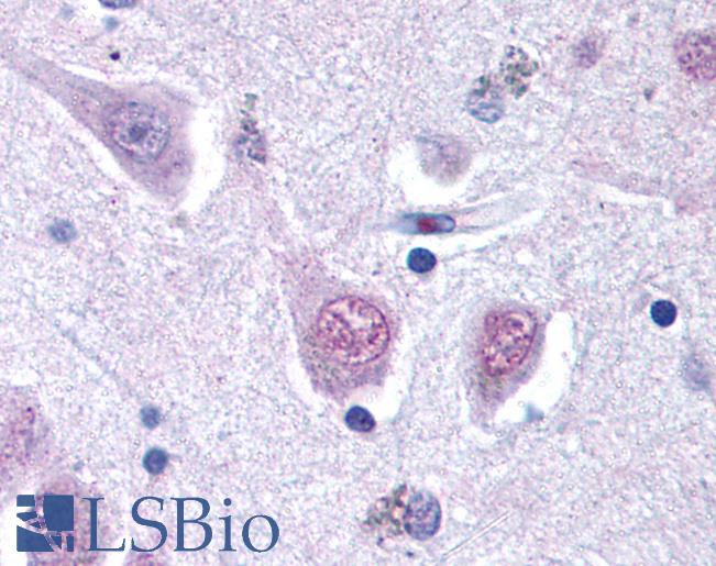 Anti-RGS2 antibody IHC of human brain, cortex. Immunohistochemistry of formalin-fixed, paraffin-embedded tissue after heat-induced antigen retrieval. Antibody LS-B122 concentration 20 ug/ml.