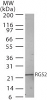 Western blot of RGS2 in human heart lysate using antibody at 2 ug/ml.