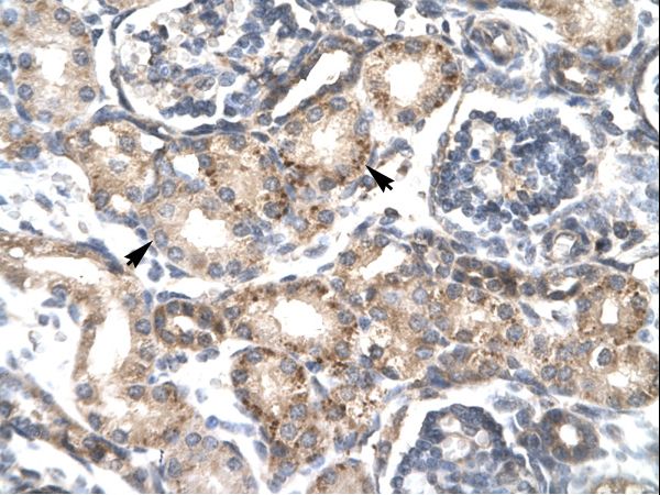 RGS20 antibody LS-C30647 was used in IHC to stain formalin-fixed, paraffin-embedded human kidney.