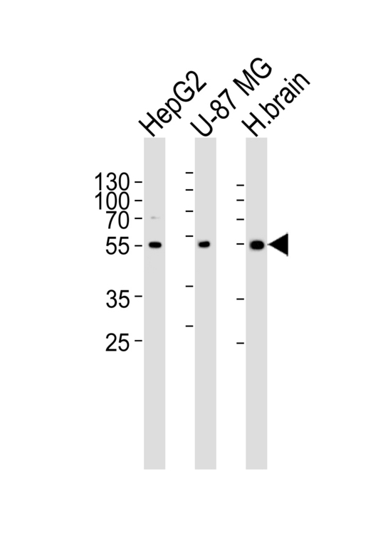 Western blot of lysates from HepG2, U-87 MG cell line and human brain tissue lysate (from left to right) with RGS20 Antibody. Antibody was diluted at 1:1000 at each lane. A goat anti-rabbit IgG H&L (HRP) at 1:5000 dilution was used as the secondary antibody. Lysates at 35 ug per lane.