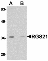 Western blot of RGS21 in HepG2 cell lysate with RGS21 antibody at 0.5 ug/ml in (A) the absence and (B) the presence of blocking peptide.