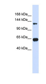 RGS22 antibody LS-C111634 Western blot of Transfected 293T cell lysate.