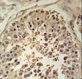 RGS22 Antibody immunohistochemistry of formalin-fixed and paraffin-embedded human testis tissue followed by peroxidase-conjugated secondary antibody and DAB staining.