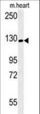 RGS22 Antibody western blot of mouse heart tissue lysates (15 ug/lane). The RGS22 antibody detected the RGS22 protein (arrow).