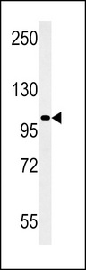 RGS22 Antibody western blot of HeLa cell line lysates (15 ug/lane). The RGS22 antibody detected the RGS22 protein (arrow).