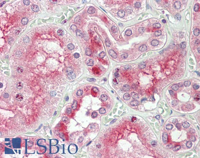 Anti-RGS22 antibody IHC staining of human kidney. Immunohistochemistry of formalin-fixed, paraffin-embedded tissue after heat-induced antigen retrieval.