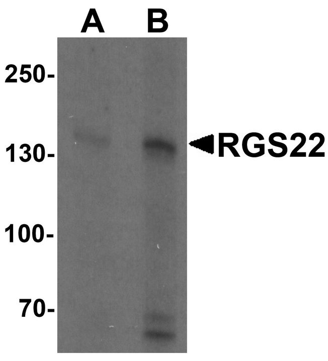 Western blot analysis of RGS22 in Jurkat cell lysate with RGS22 antibody at (A) 1 and (B) 2 ug/ml.