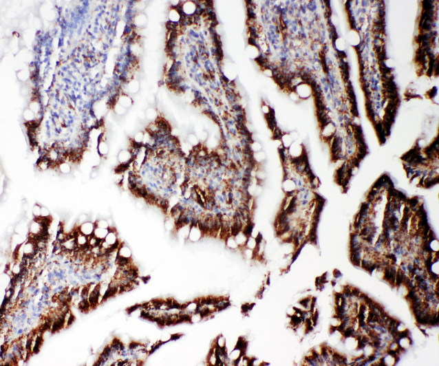 RGS3 antibody. IHC(P): Rat Intestine Tissue.