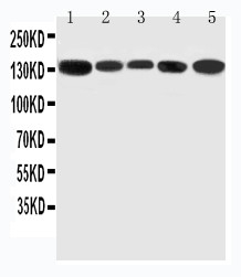 WB of RGS3 antibody. Lane 1: Rat Testis Tissue Lysate. Lane 2: Rat Brain Tissue Lysate. Lane 3: Rat Spleen Tissue Lysate. Lane 4: HELA Cell Lysate. Lane 5: U87 Cell Lysate.