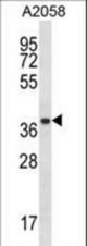 PSMA1 Antibody western blot of A2058 cell line lysates (35 ug/lane). The PSMA1 antibody detected the PSMA1 protein (arrow).
