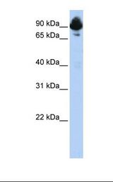 HepG2 cell lysate. Antibody concentration: 1.0 ug/ml. Gel concentration: 12%.