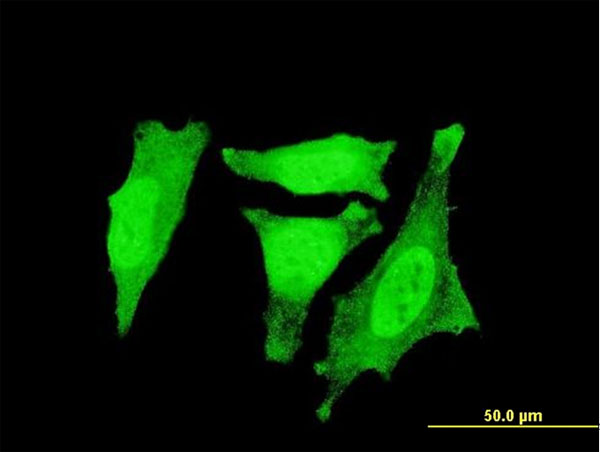 Immunofluorescence of monoclonal antibody to RGS3 on HeLa cell. [antibody concentration 10 ug/ml].