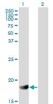 Western blot of RGS3 expression in transfected 293T cell line by RGS3 monoclonal antibody clone 1E8-C7.