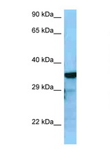 RGS4 antibody LS-C146322 Western blot of HepG2 Cell lysate. Antibody concentration 1 ug/ml.