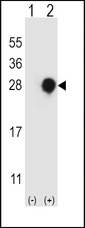 Western blot of RGS4 (arrow) using rabbit polyclonal RGS4 Antibody. 293 cell lysates (2 ug/lane) either nontransfected (Lane 1) or transiently transfected (Lane 2) with the RGS4 gene.