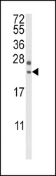 Western blot of RGS4 Antibody in mouse brain tissue lysates (35 ug/lane). RGS4 (arrow) was detected using the purified antibody.