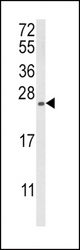 Western blot of RGS4 Antibody in MDA-MB231 cell line lysates (35 ug/lane). RGS4 (arrow) was detected using the purified antibody.