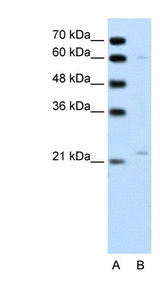 RGS4 antibody LS-B997 Western blot of Jurkat lysate.