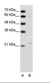 A: Marker, B: Jurkat Cell Lysate
