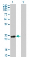 Western blot of RGS5 in 1) transfected 293T cells and 2) untransfected 293T cells using LS-C148388 at 1:500.