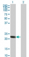 Western blot of RGS5 in 1) transfected 293T cells and 2) untransfected 293T cells.