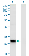 Western Blot analysis of RGS5 expression in transfected 293T cell line by RGS5 monoclonal antibody (M01), clone 4E12.Lane 1: RGS5 transfected lysate (Predicted MW: 20.9 KDa).Lane 2: Non-transfected lysate.