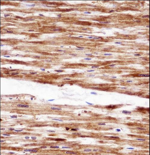 RGS5 Antibody immunohistochemistry of formalin-fixed and paraffin-embedded human heart tissue followed by peroxidase-conjugated secondary antibody and DAB staining.