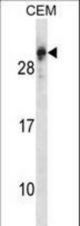 RGS5 Antibody western blot of CEM cell line lysates (35 ug/lane). The RGS5 antibody detected the RGS5 protein (arrow).