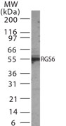 Western blot of RGS6 in 30 ugs of mouse brain tissue lysate using antibody at 1:1000 dilution.