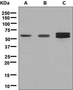 Western blot analysis on (A) Y79, (B) HeLa, and (C) Jurkat cell lysates using anti-RGS6 antibody.