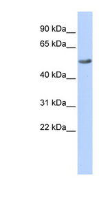 RGS6 antibody LS-C101477 Western blot of Jurkat lysate.