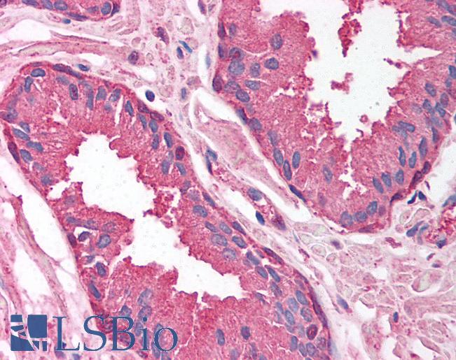 Anti-PSMA1 antibody IHC of human prostate. Immunohistochemistry of formalin-fixed, paraffin-embedded tissue after heat-induced antigen retrieval. Antibody LS-B1558 concentration 5 ug/ml.