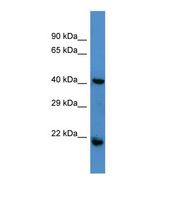 Western blot of Human Jurkat. RGS7 antibody dilution 1.0 ug/ml.