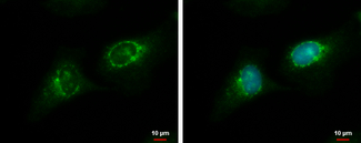 Anti-RGS7 antibody used in ICC/IF.