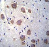 RGS7 Antibody immunohistochemistry of formalin-fixed and paraffin-embedded human brain tissue followed by peroxidase-conjugated secondary antibody and DAB staining.