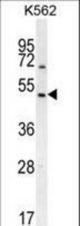 RGS7 Antibody western blot of K562 cell line lysates (35 ug/lane). The RGS7 antibody detected the RGS7 protein (arrow).