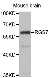 Western blot analysis of extracts of Mouse brain cell line, using RGS7 antibody.