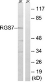 Western blot of extracts from Jurkat cells, using RGS7 Antibody. The lane on the right is treated with the synthesized peptide.